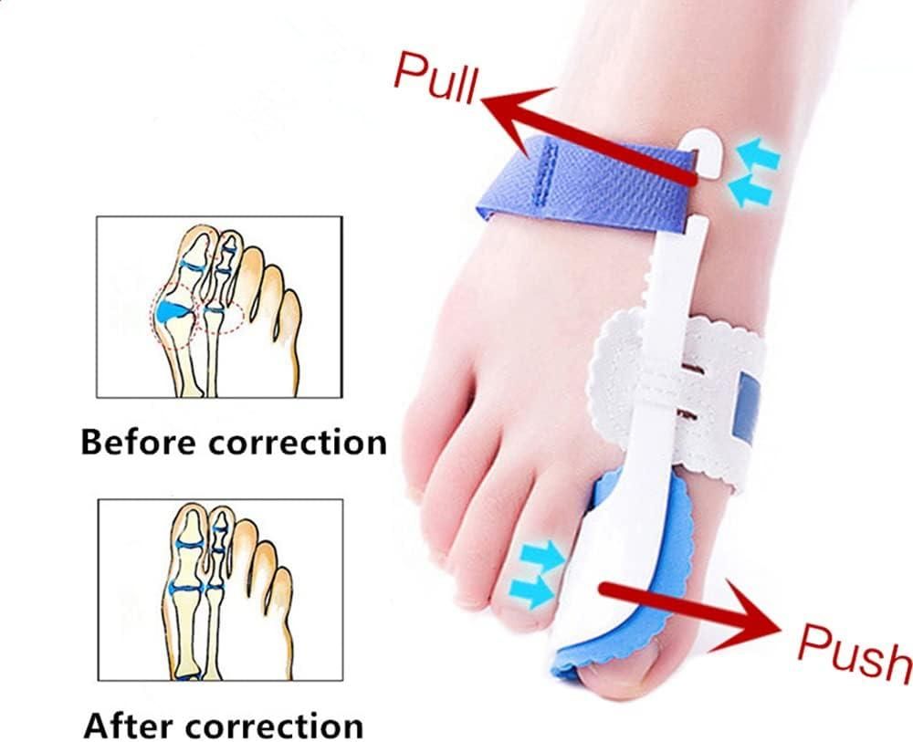 Foot Orthotic Bunion Splint Crooked  Thumb Corrector (1 Pair)